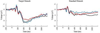 The Role of Retinal Carotenoids and Age on Neuroelectric Indices of Attentional Control among Early to Middle-Aged Adults